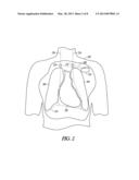 NEURAL CONTROL OF CENTRAL SLEEP APNEA diagram and image