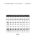 NEURAL CONTROL OF CENTRAL SLEEP APNEA diagram and image