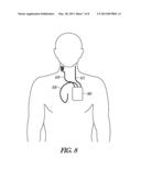 NEURAL CONTROL OF CENTRAL SLEEP APNEA diagram and image