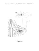 APPARATUS AND METHODS FOR FEEDBACK-BASED NERVE MODULATION diagram and image