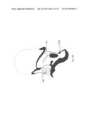 RELAY MODULE FOR IMPLANT diagram and image