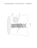 RELAY MODULE FOR IMPLANT diagram and image