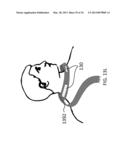 RELAY MODULE FOR IMPLANT diagram and image