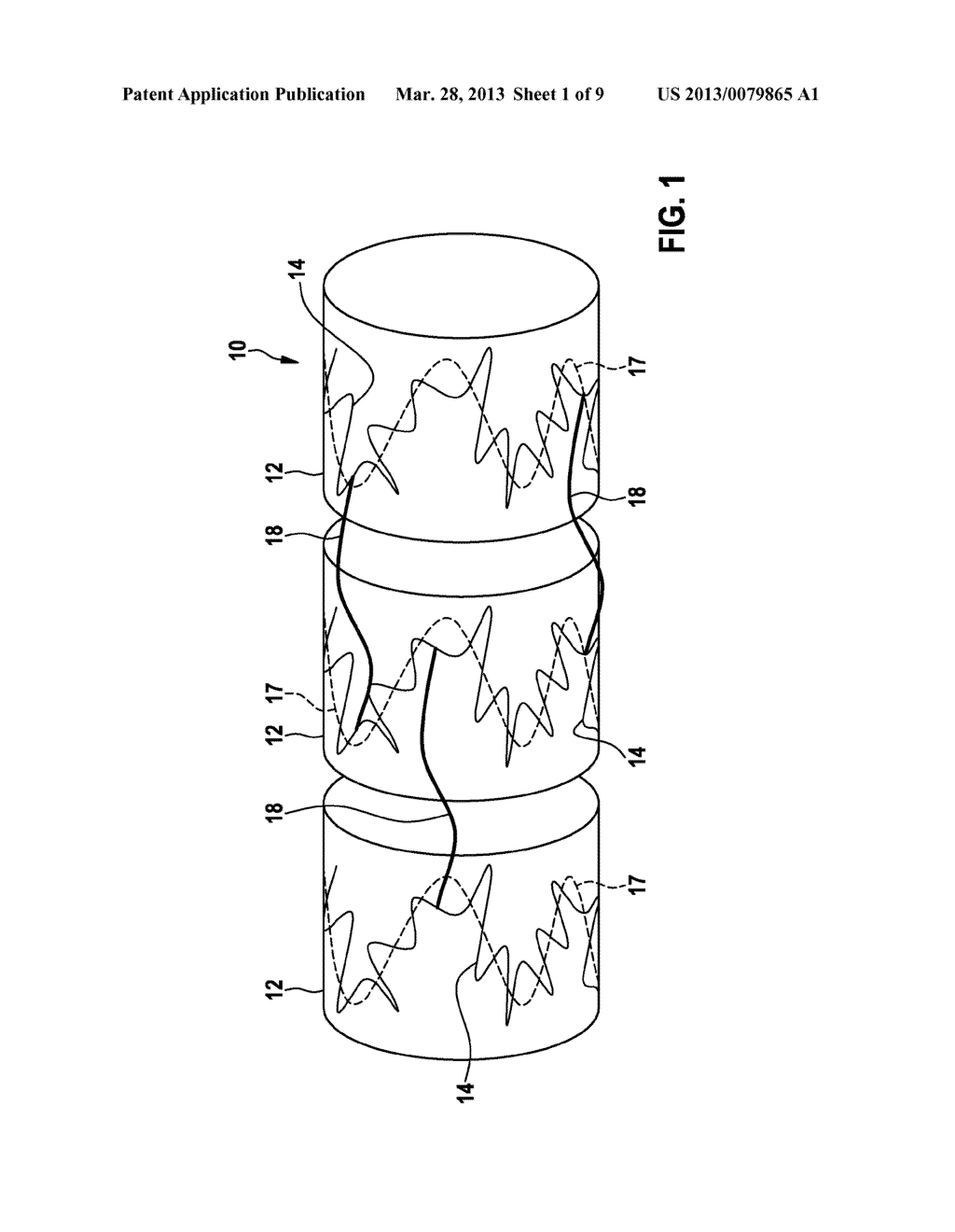 IMPLANT AND METHOD FOR MANUFACTURING THE SAME - diagram, schematic, and image 02
