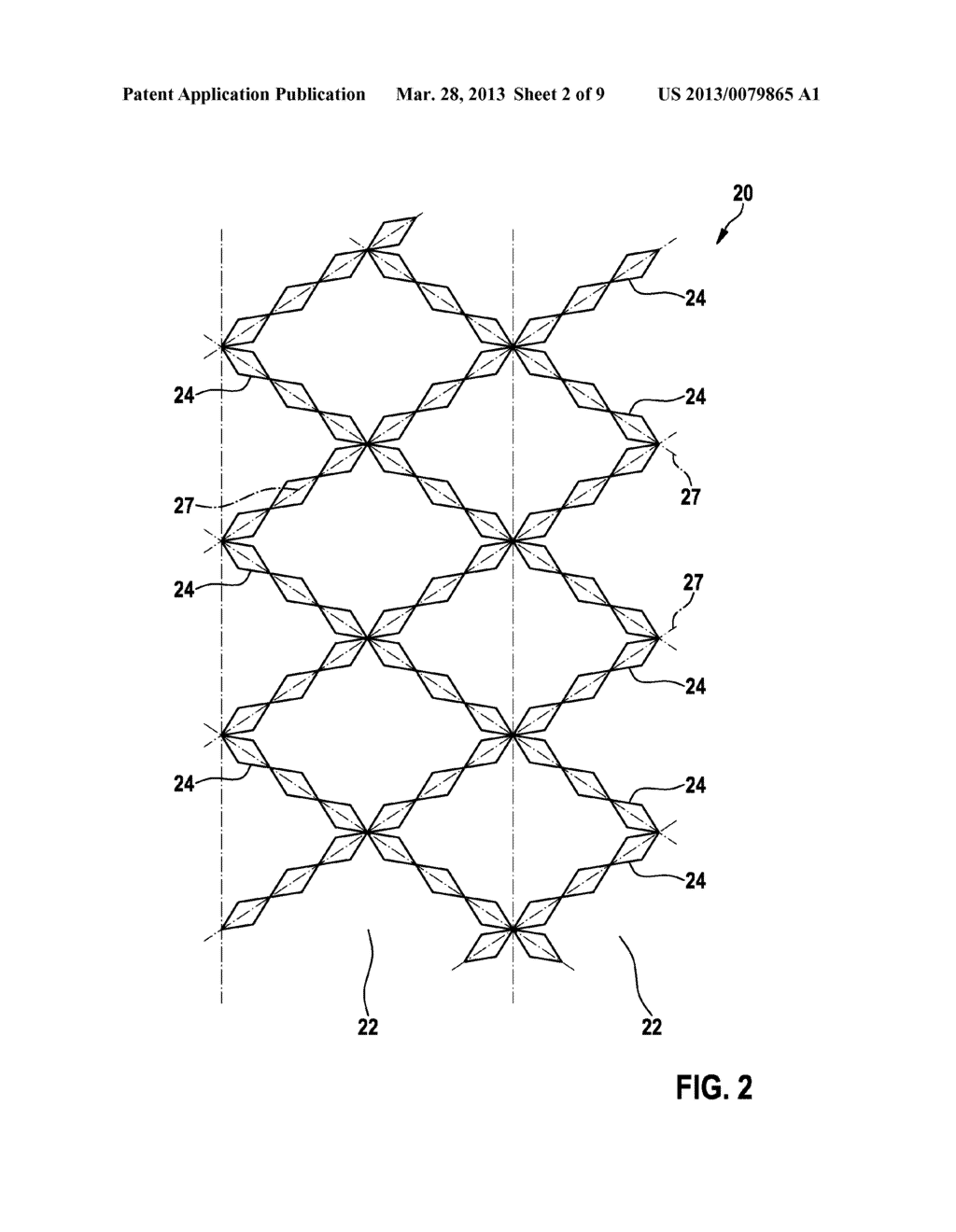 IMPLANT AND METHOD FOR MANUFACTURING THE SAME - diagram, schematic, and image 03