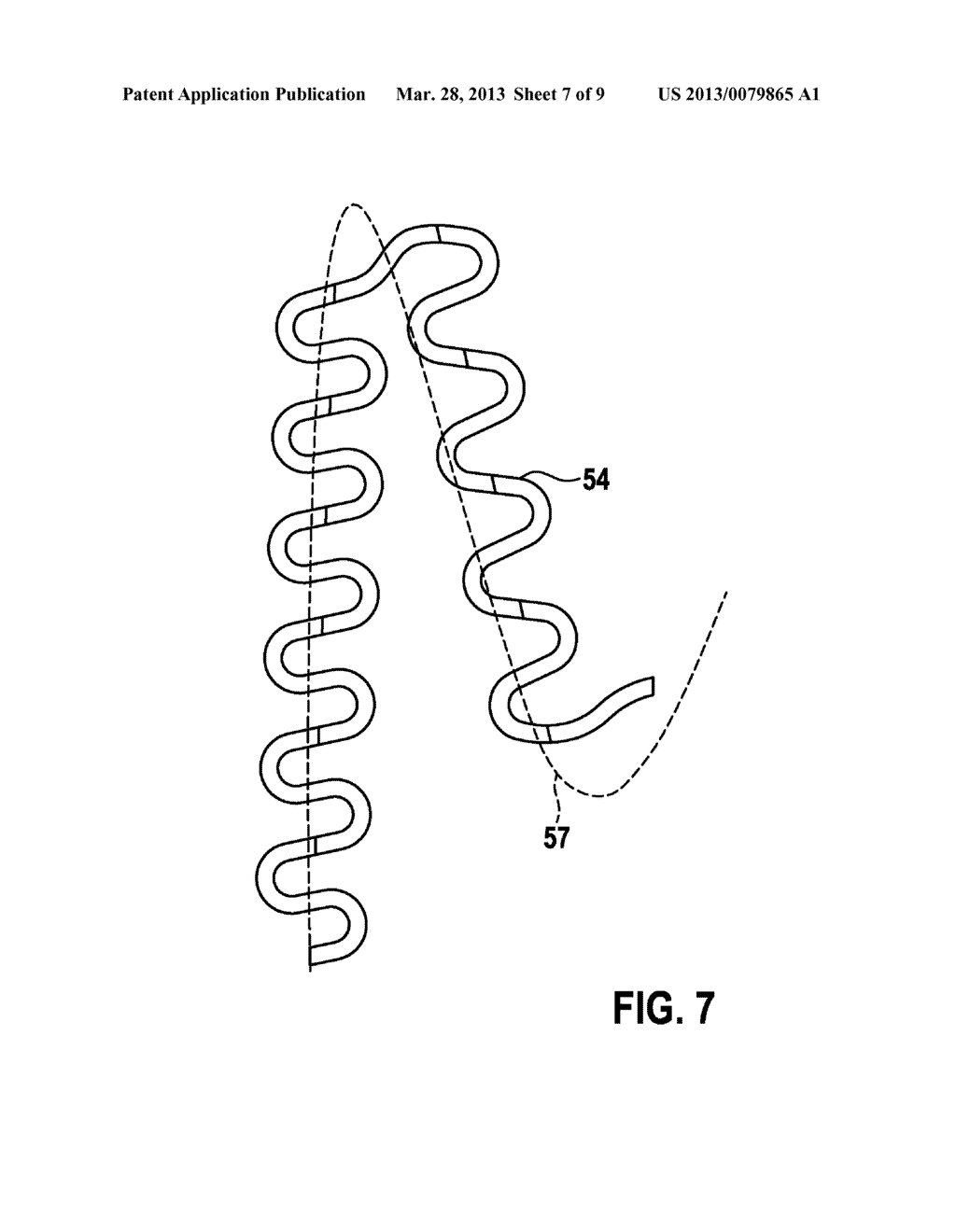 IMPLANT AND METHOD FOR MANUFACTURING THE SAME - diagram, schematic, and image 08