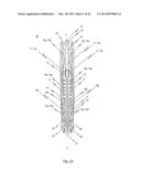 STENT FOR THE POSITIONING AND ANCHORING OF A VALVULAR PROSTHESIS IN AN     IMPLANTATION SITE IN THE HEART OF A PATIENT diagram and image