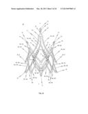 STENT FOR THE POSITIONING AND ANCHORING OF A VALVULAR PROSTHESIS IN AN     IMPLANTATION SITE IN THE HEART OF A PATIENT diagram and image