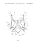 STENT FOR THE POSITIONING AND ANCHORING OF A VALVULAR PROSTHESIS IN AN     IMPLANTATION SITE IN THE HEART OF A PATIENT diagram and image