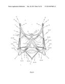 STENT FOR THE POSITIONING AND ANCHORING OF A VALVULAR PROSTHESIS IN AN     IMPLANTATION SITE IN THE HEART OF A PATIENT diagram and image