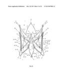 STENT FOR THE POSITIONING AND ANCHORING OF A VALVULAR PROSTHESIS IN AN     IMPLANTATION SITE IN THE HEART OF A PATIENT diagram and image