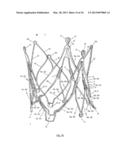 STENT FOR THE POSITIONING AND ANCHORING OF A VALVULAR PROSTHESIS IN AN     IMPLANTATION SITE IN THE HEART OF A PATIENT diagram and image