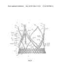 STENT FOR THE POSITIONING AND ANCHORING OF A VALVULAR PROSTHESIS IN AN     IMPLANTATION SITE IN THE HEART OF A PATIENT diagram and image