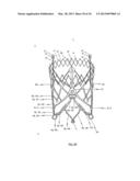 STENT FOR THE POSITIONING AND ANCHORING OF A VALVULAR PROSTHESIS IN AN     IMPLANTATION SITE IN THE HEART OF A PATIENT diagram and image