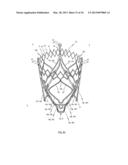 STENT FOR THE POSITIONING AND ANCHORING OF A VALVULAR PROSTHESIS IN AN     IMPLANTATION SITE IN THE HEART OF A PATIENT diagram and image