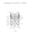 STENT FOR THE POSITIONING AND ANCHORING OF A VALVULAR PROSTHESIS IN AN     IMPLANTATION SITE IN THE HEART OF A PATIENT diagram and image