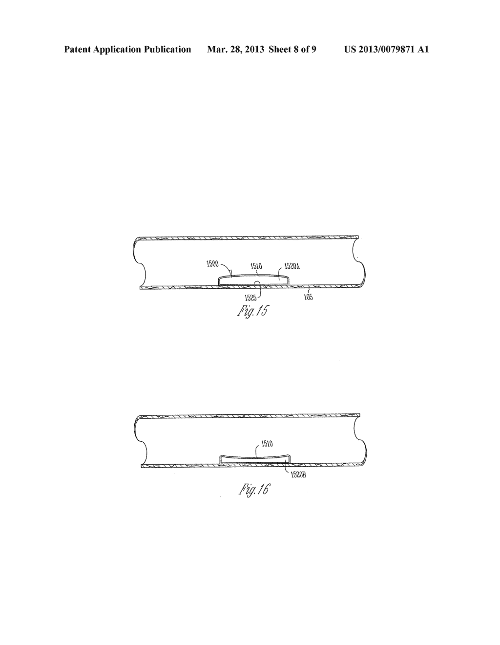 VASCULAR ELASTANCE - diagram, schematic, and image 09