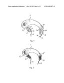 NON-RESORBABLE MENISCUS PROSTHESIS FOR THE HUMAN KNEE JOINT diagram and image