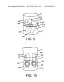 Flexible Anchoring and Fusion Devices and Methods of Using the Same diagram and image