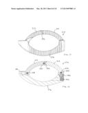 RADIALLY EXPANDABLE SPINAL INTERBODY DEVICE AND IMPLANTATION TOOL diagram and image