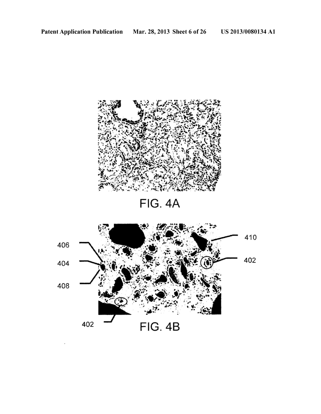 SYSTEMS AND METHODS FOR PREDICTING FAVORABLE-RISK DISEASE FOR PATIENTS     ENROLLED IN ACTIVE SURVEILLANCE - diagram, schematic, and image 07