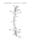 Bow Handle and Limb Attachment Mechanism diagram and image