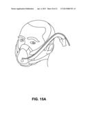 MAINTAINING A WATER LEVEL IN A HUMIDIFICATION COMPONENT diagram and image