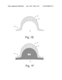 REMOVING CONDUCTIVE MATERIAL TO FORM CONDUCTIVE FEATURES IN A SUBSTRATE diagram and image