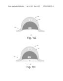 REMOVING CONDUCTIVE MATERIAL TO FORM CONDUCTIVE FEATURES IN A SUBSTRATE diagram and image