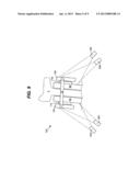 Brake component monitoring diagram and image