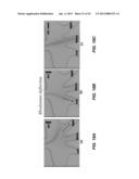 FLUIDIC FLOW CYTOMETRY DEVICES AND METHODS diagram and image