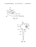 PRESSURE SENSING EARBUDS AND SYSTEMS AND METHODS FOR THE USE THEREOF diagram and image