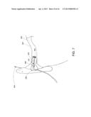 INSTABILITY DETECTION AND AVOIDANCE IN A FEEDBACK SYSTEM diagram and image