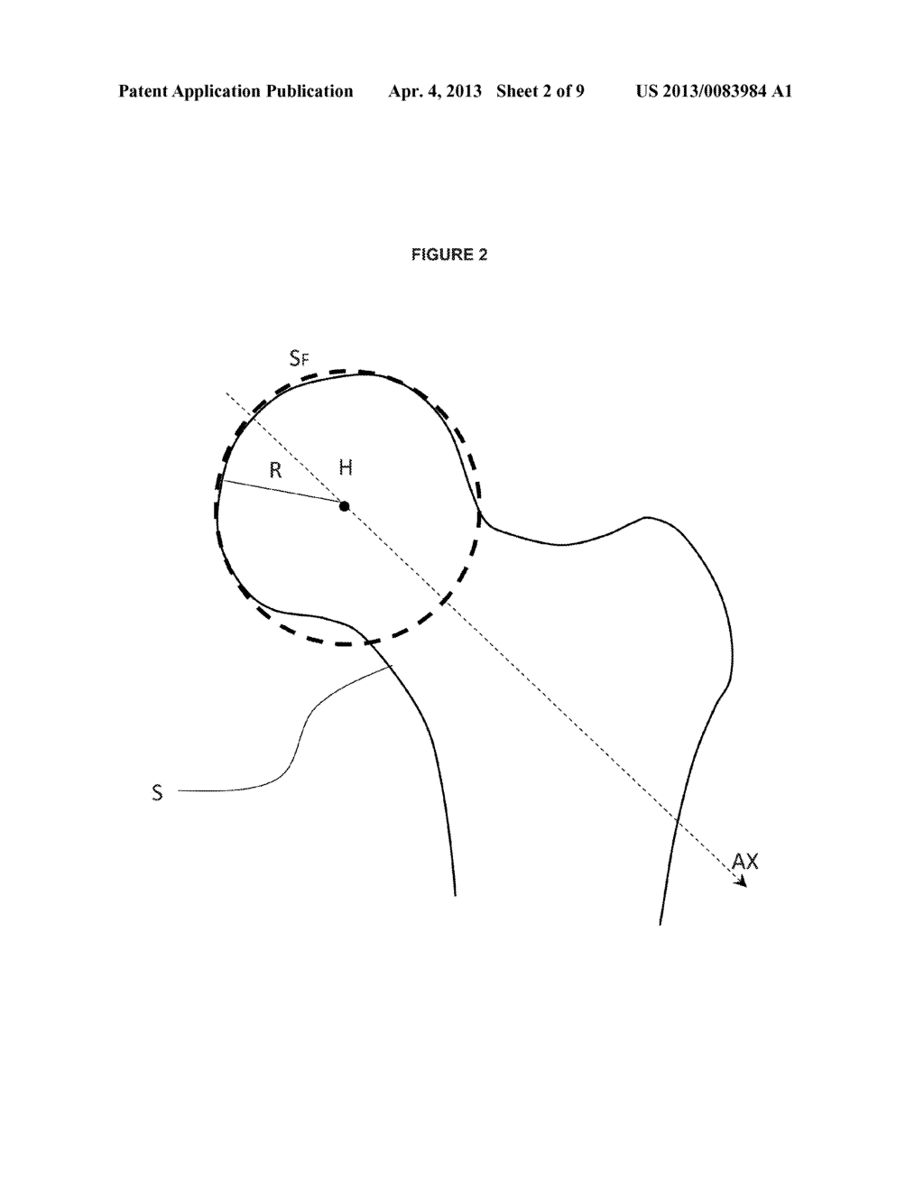 METHOD AND SYSTEM OF AUTOMATIC DETERMINATION OF GEOMETRIC ELEMENTS     CHARACTERIZING A BONE DEFORMATION FROM 3D IMAGE - diagram, schematic, and image 03