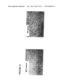 STEM CELLS FROM ADIPOSE TISSUE, AND DIFFERENTIATED CELLS FROM SAID CELLS diagram and image