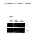 STEM CELLS FROM ADIPOSE TISSUE, AND DIFFERENTIATED CELLS FROM SAID CELLS diagram and image