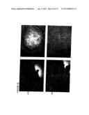 STEM CELLS FROM ADIPOSE TISSUE, AND DIFFERENTIATED CELLS FROM SAID CELLS diagram and image