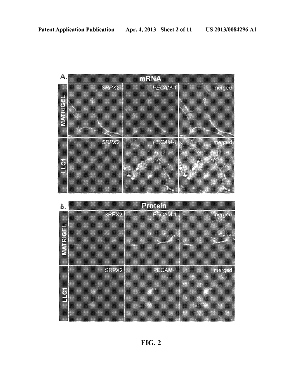 MODULATION OF SRPX2-MEDIATED ANGIOGENESIS - diagram, schematic, and image 03