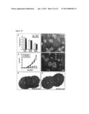 DIAGNOSIS AND PREVENTION OF CANCER CELL INVASION diagram and image