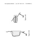 COMPOSITIONS AND METHODS FOR PLATELET ENRICHED FIBRIN CONSTRUCTS diagram and image