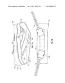 METHODS AND APPARATUS FOR AN ORTHODONTIC HEADGEAR SLIP diagram and image