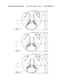 Golf Club and Golf Club Head Structures diagram and image