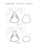 Golf Club and Golf Club Head Structures diagram and image