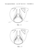 Golf Club and Golf Club Head Structures diagram and image