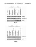 MicroRNA-Based Methods and Compositions for the Diagnosis, Prognosis and     Treatment of Prostate Related Disorders diagram and image