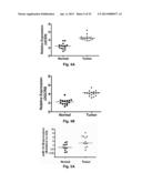 MicroRNA-Based Methods and Compositions for the Diagnosis, Prognosis and     Treatment of Prostate Related Disorders diagram and image