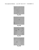 MicroRNA-Based Methods and Compositions for the Diagnosis, Prognosis and     Treatment of Prostate Related Disorders diagram and image