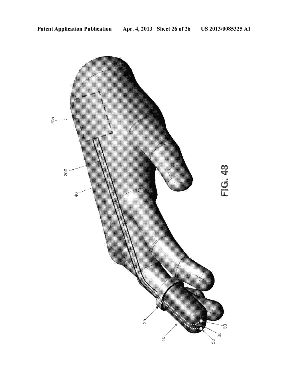 HAND-MOUNTED, VIDEO-GUIDED SYSTEM FOR TREATING PERITONITIS AND OTHER     MEDICAL CONDITIONS - diagram, schematic, and image 27