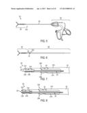 METHODS AND DEVICES FOR MANIPULATING TISSUE IN VIVO diagram and image