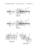 METHODS AND DEVICES FOR MANIPULATING TISSUE IN VIVO diagram and image